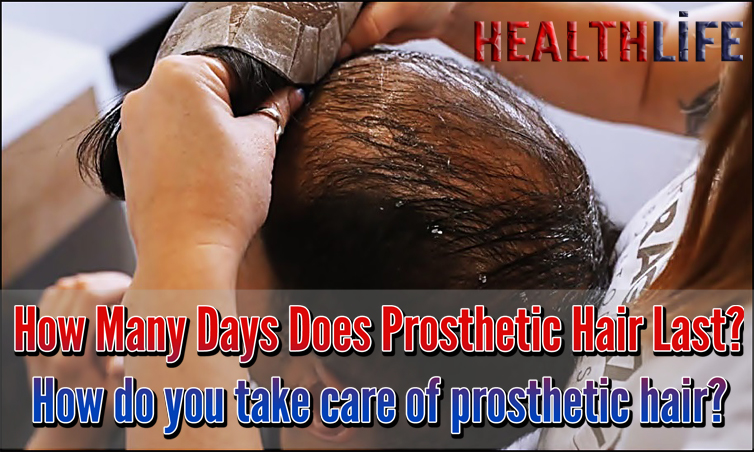 How Many Days Does Prosthetic Hair Last
