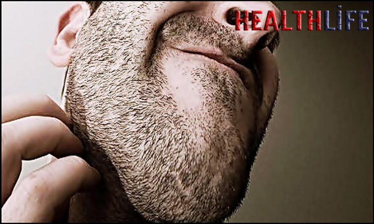 How To Stop A Beard From Itching
