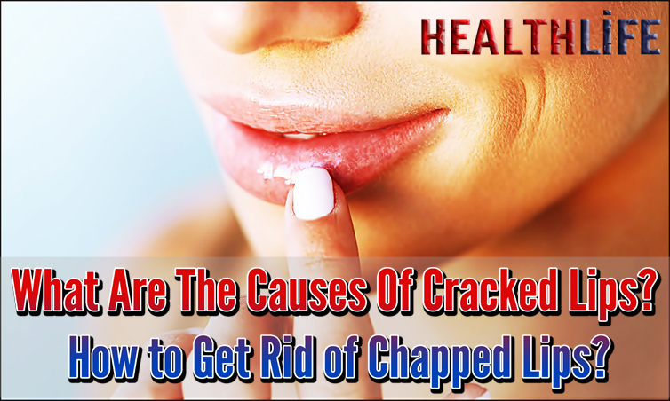 What Are The Causes Of Cracked Lips