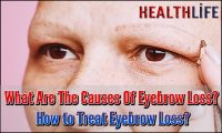 What Are The Causes Of Eyebrow Loss