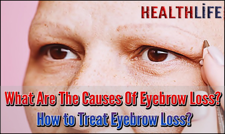 What Are The Causes Of Eyebrow Loss