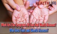 What Are The Symptoms Of Foot And Mouth Disease