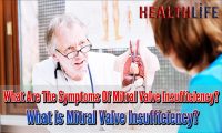 What Are The Symptoms Of Mitral Valve Insufficiency