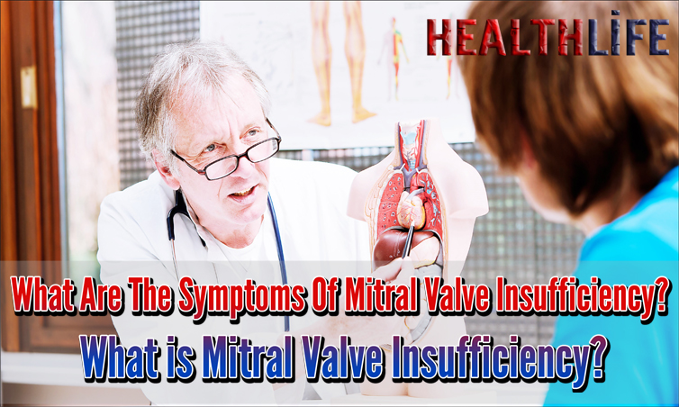 What Are The Symptoms Of Mitral Valve Insufficiency
