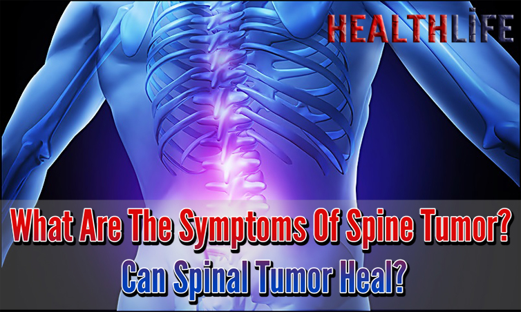 What Are The Symptoms Of Spine Tumor