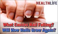 What Causes Nail Falling