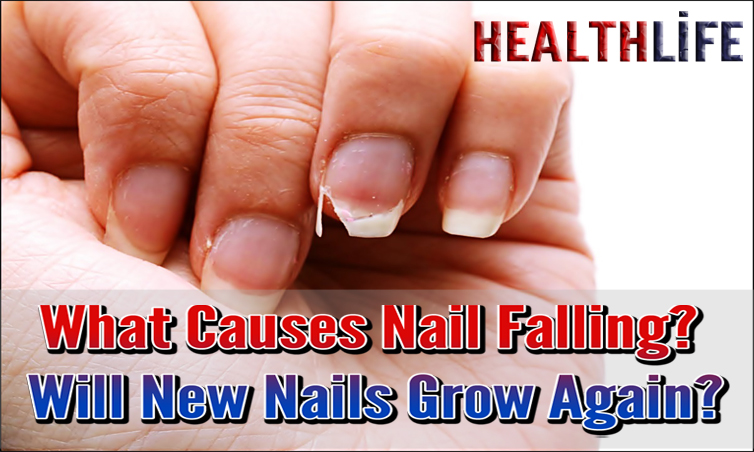 What Causes Nail Falling