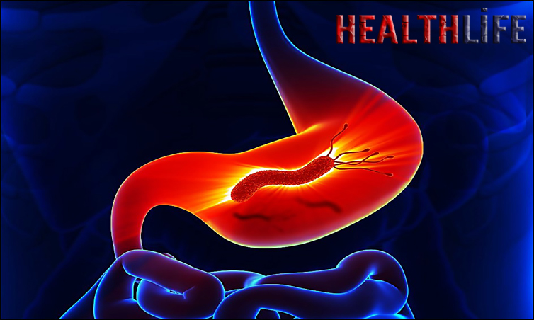 What Is The First Symptom Of Helicobacter Pylori