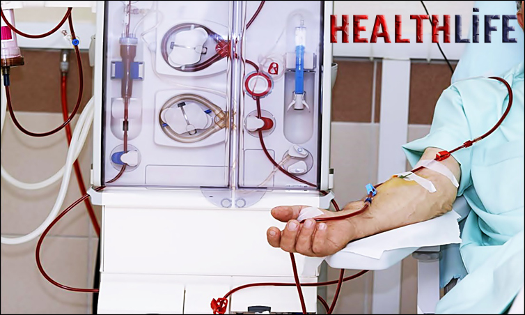 At What Stage Do You Go On Dialysis