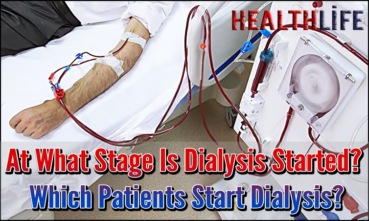 At What Stage Is Dialysis Started