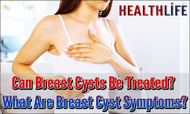 Can Breast Cysts Be Treated