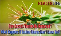 Can Cactus Thorns Be Removed