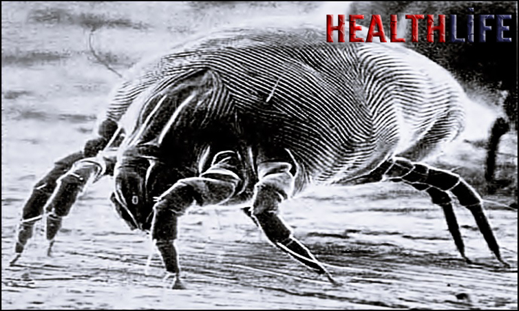 Can You Overcome a Dust Allergy