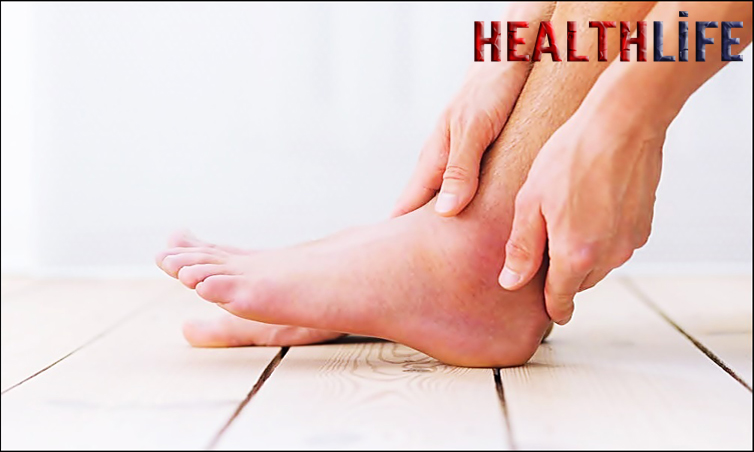 How Do I Know If my Ankle Is Sprained