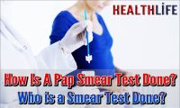 How Is A Pap Smear Test Done