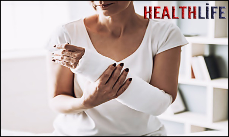 How Long Does It Take For a Fractured Upper Arm Bone To Heal