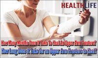 How Many Months Does It Take To Heal An Upper Arm Fracture