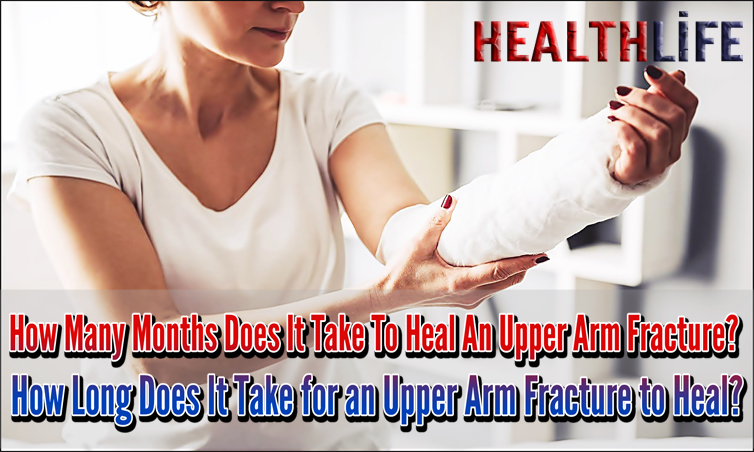 How Many Months Does It Take To Heal An Upper Arm Fracture