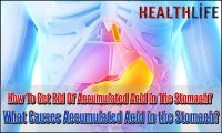 How To Get Rid Of Accumulated Acid In The Stomach