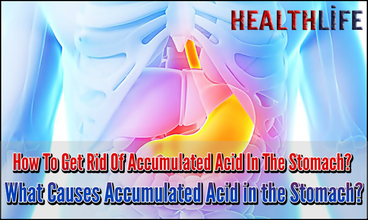 How To Get Rid Of Accumulated Acid In The Stomach