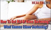 How To Get Rid Of Knee Darkening