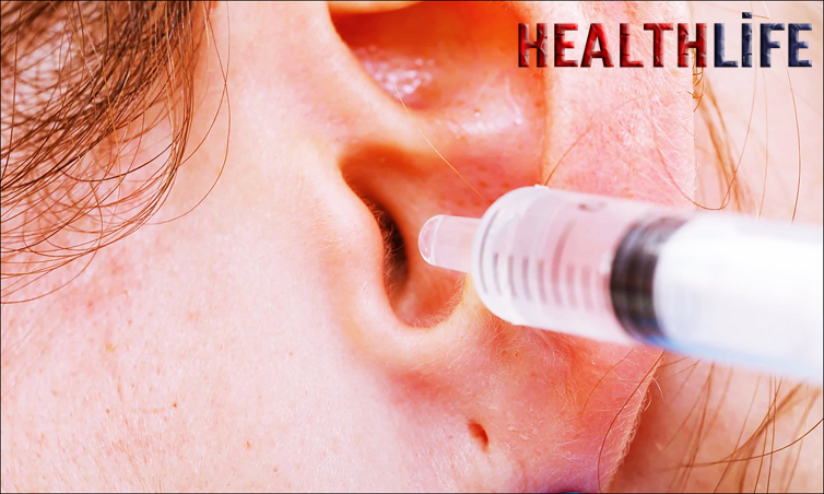 How to Clean Ears