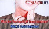 What Are The Causes Of Tonsil Infection
