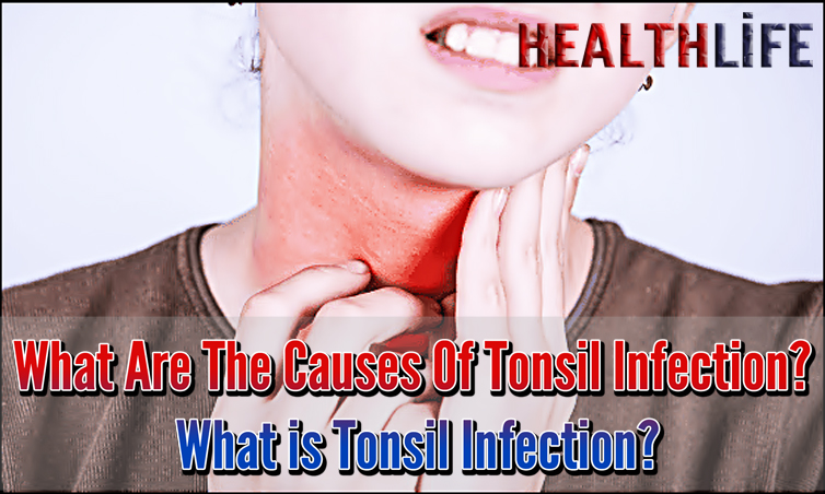 What Are The Causes Of Tonsil Infection