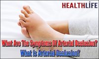 What Are The Symptoms Of Arterial Occlusion