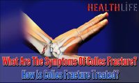 What Are The Symptoms Of Colles Fracture