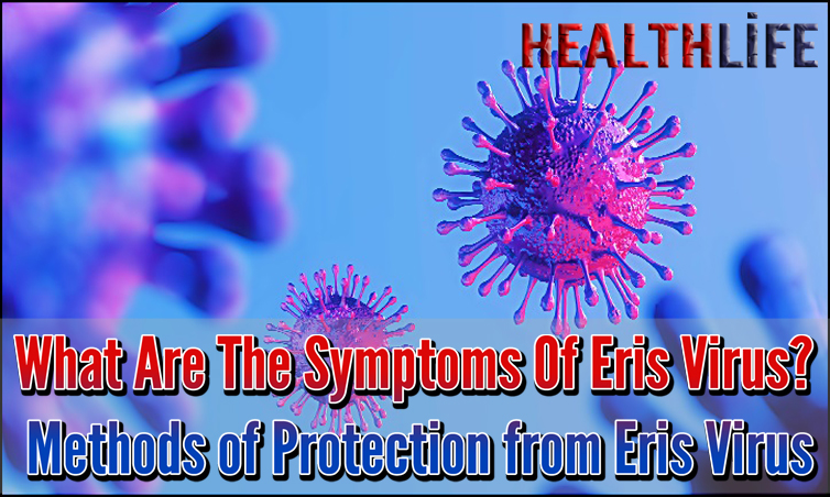 What Are The Symptoms Of Eris Virus