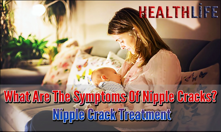 What Are The Symptoms Of Nipple Cracks