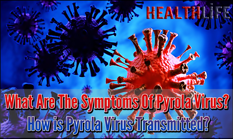 What Are The Symptoms Of Pyrola Virus