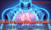 What Are The Symptoms Of Rheumatic Heart Disease