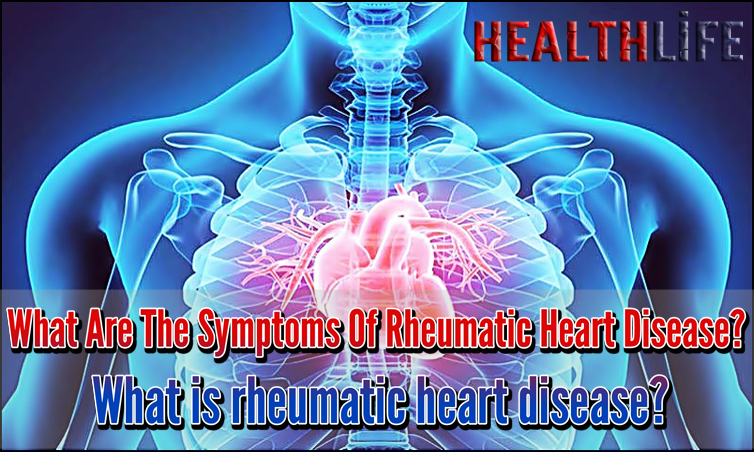 What Are The Symptoms Of Rheumatic Heart Disease