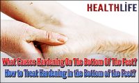 How Do You Treat Hardness On The Bottom Of Your Feet