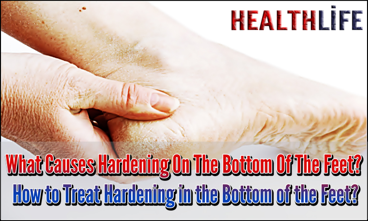 How Do You Treat Hardness On The Bottom Of Your Feet