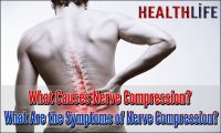 What Causes Nerve Compression