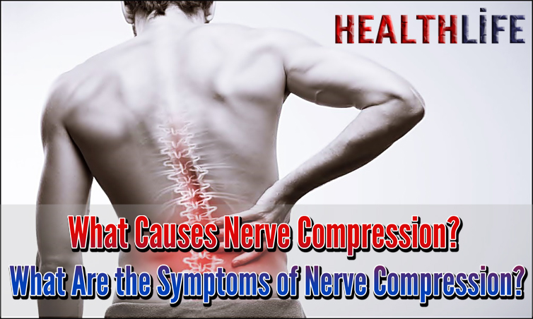 What Causes Nerve Compression