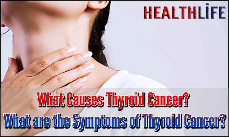 What Causes Thyroid Cancer