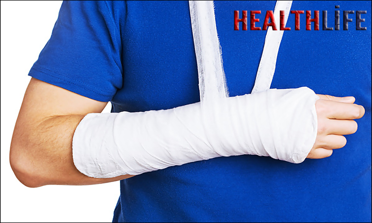What Does A Colles Fracture Affect