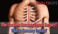 Who Can Have Coronary Bypass Surgery