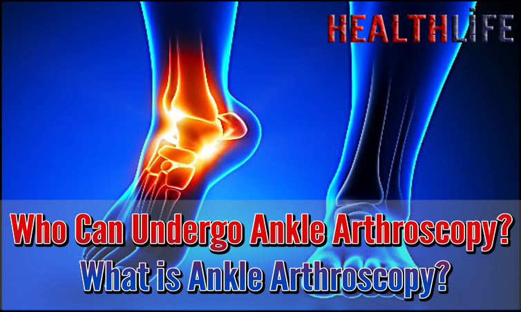 Who Can Undergo Ankle Arthroscopy