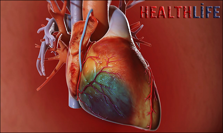 Who Is Eligible For Heart Bypass Surgery