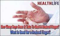 How Many Days Does It Take To Heal A Bruised Finger