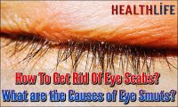 How To Get Rid Of Eye Scabs