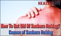 How To Get Rid Of Sunburn Itching