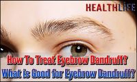 How To Treat Eyebrow Dandruff