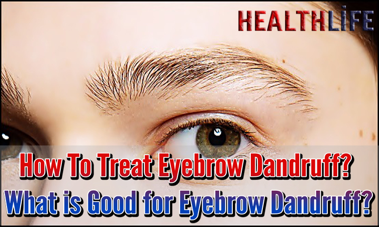 How To Treat Eyebrow Dandruff