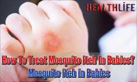 How To Treat Mosquito Itch In Babies